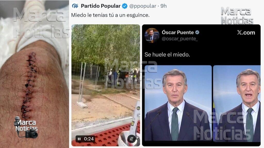 El PP inicia la precampaña con un vídeo en el que se burla de una lesión de Óscar Puente: “Miedo, tu esguince”